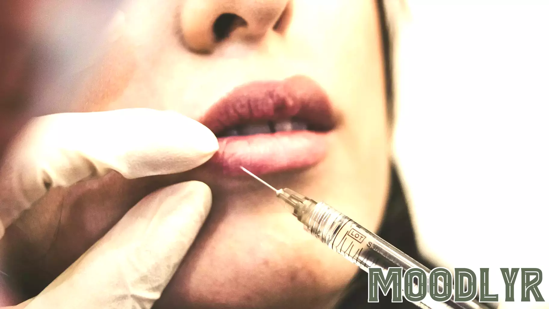 The Psychology of Patient Consultations: Why Clinical Skills Alone Don't Guarantee Success in Aesthetic Medicine