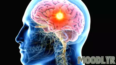 Essential Habits for Optimal Brain Health According to a Neuroscientist